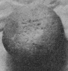 111x117 pixels (14K)