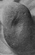 119x197 pixels (10K)